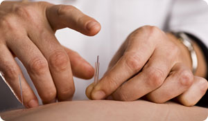 Could Acupuncture Help Treat Diabetes?