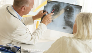 Can Asthma Lead to Lung Cancer?