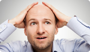 Can Baldness Be Cured?