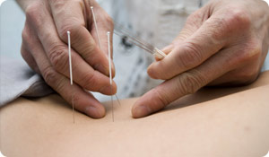 Can Acupuncture Ease Eczema?